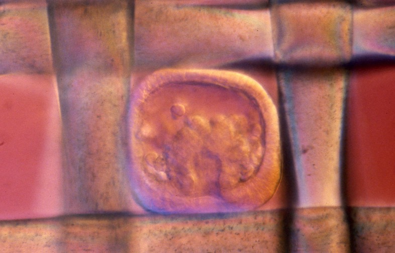 L. variegatus mid-gastrula in Nitex mesh [J. Hardin]