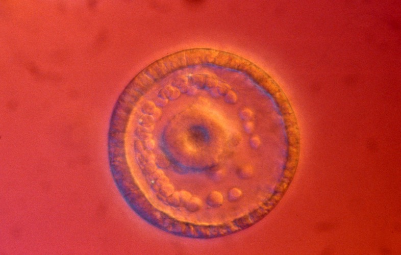 L. variegatus late gastrula - vegetal view