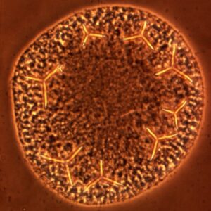 L. variegatus gastrula - NiCl2 treated (vegetal) [J. Hardin]