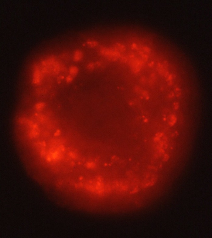 L. variegatus NiCl2 treated pluteus with normal PMCs