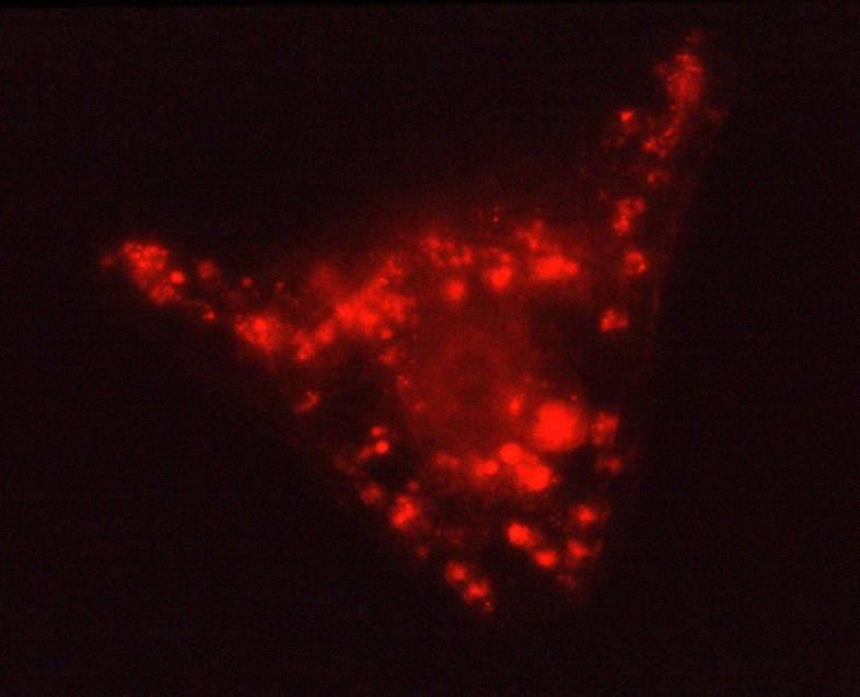 L. variegatus pluteus with NiCl2 treated PMCs