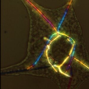 L. variegatus pluteus - NiCl2 - polarization microscopy