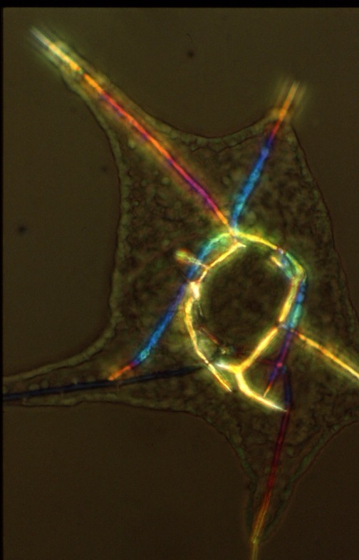 L. variegatus pluteus - NiCl2 - polarization microscopy