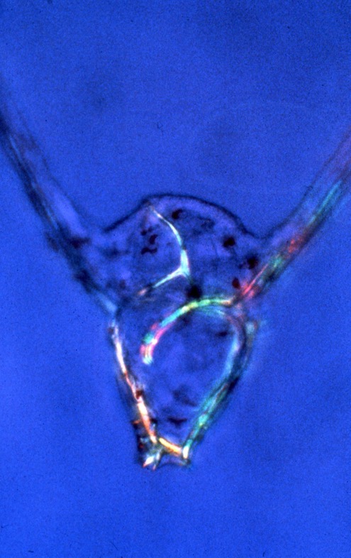 L. variegatus pluteus - animal pole removed at gastrula