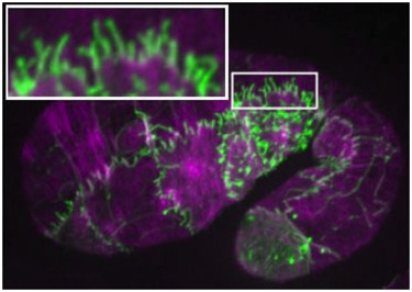 SRGP-1 overexpression