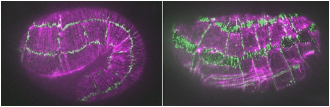 unc-94; hmp-1(fe4) defects