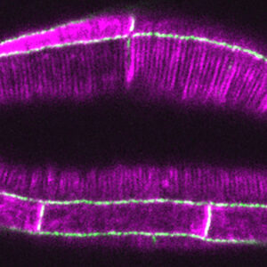 HMP-1 (green)/LifeAct (magenta)