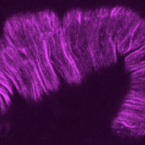 lifeact mCherry in let-502(RNAi) embryo