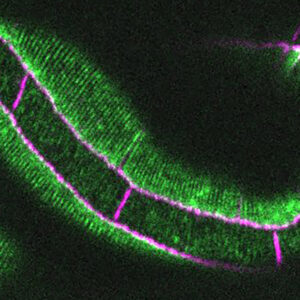 LIM-8 (green)/HMP-1(magenta)